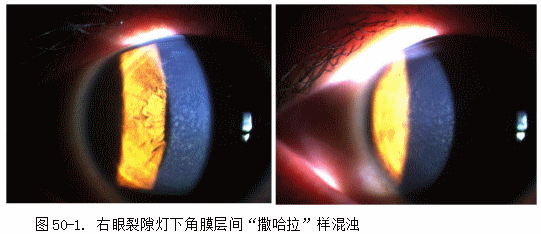 ZY016_268_2.gif